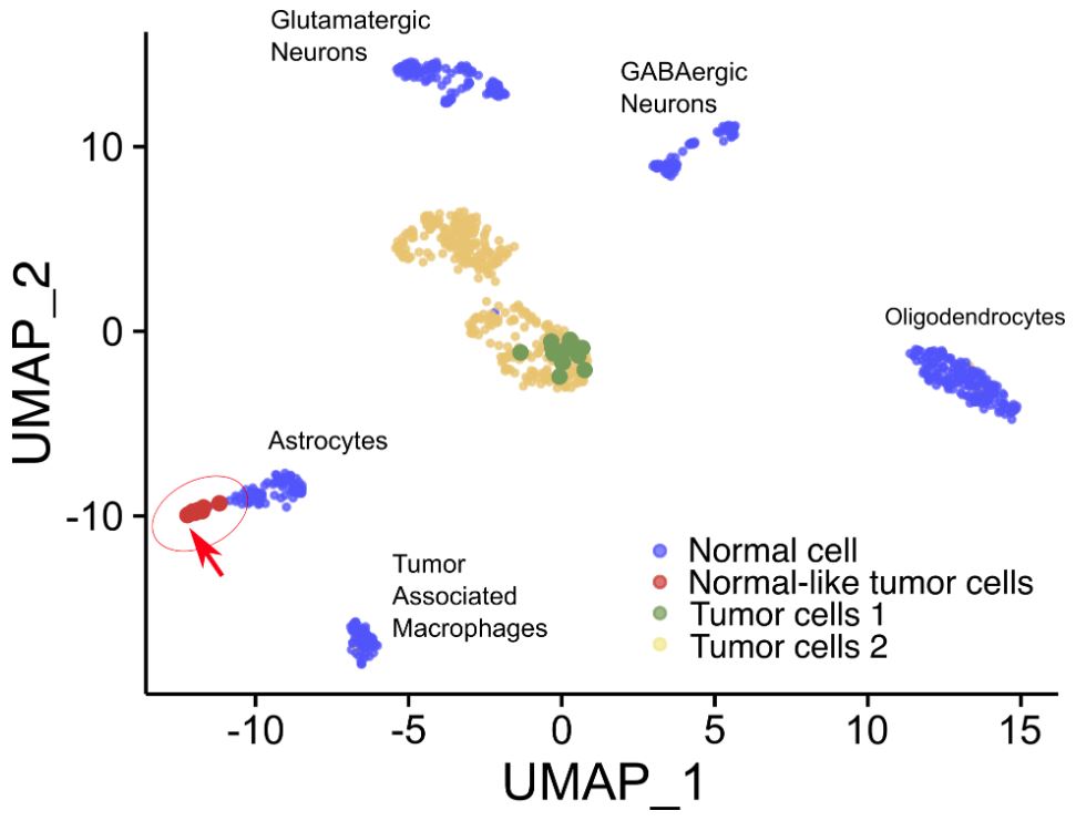 The team identifies rare brain tumor cell "spies" disguised as normal cells using this novel method