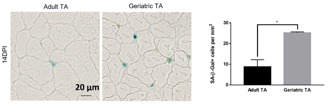 Figure 1: Injured geriatric muscle shows increased signs of senescence. Adult and geriatric Tibialis anterior (TA) muscle was injured and was stained for the presence of the senescence marker, SA-β-gal (seen as a blue stain, left). Geriatric TA muscles showed an increased percentage of SA-β-gal positive cells compared to their younger counterparts (right).