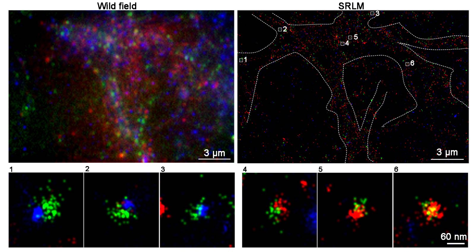  Images taken by HKUST’s SRLM microscope (upper right – break down to 1-6) are much sharper than those by regular ones (upper left), allowing researchers to discover for the first time that ATM (blue) and ATR (red) were never found on the same synaptic vesicle (green).