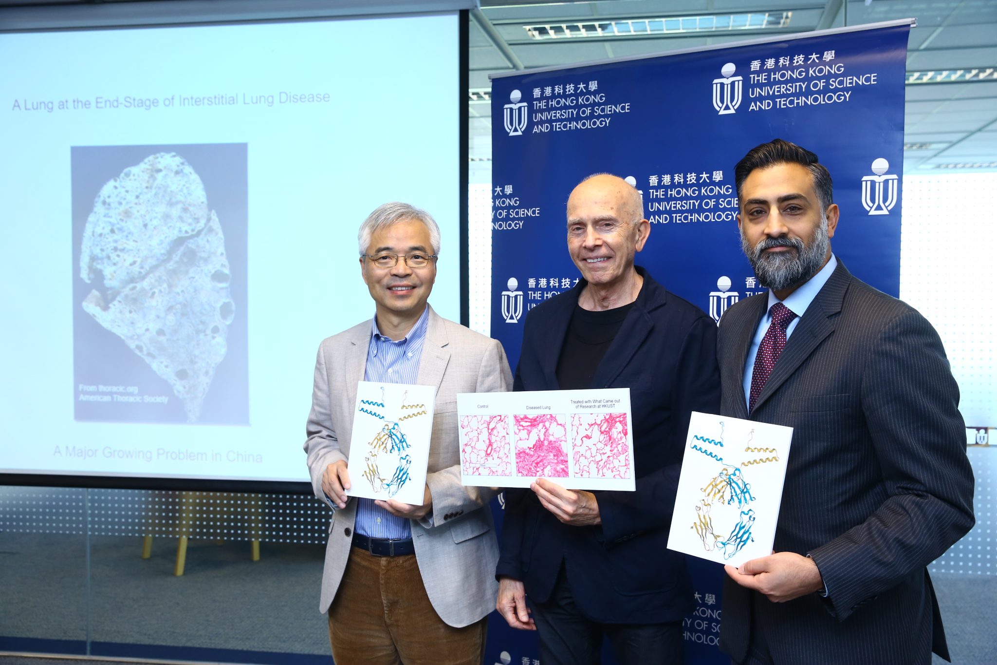 HKUST Chair Professor of the Division of Life Science and project coordinator of the Pangu collaboration Prof. ZHANG Mingjie (left); Co-founder and Director of aTyr Pharma and Senior Visiting Fellow at HKUST’s Institute for Advanced Study Prof. Paul SCHIMMEL (middle) and President and CEO of aTyr Dr. Sanjay SHUKLA (right) introduce how aTyr1923 can modulate interstitial lung disease.