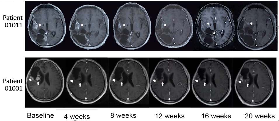 Two patients experienced significant tumor shrinkage lasting for more than 12 weeks in the clinical trial.