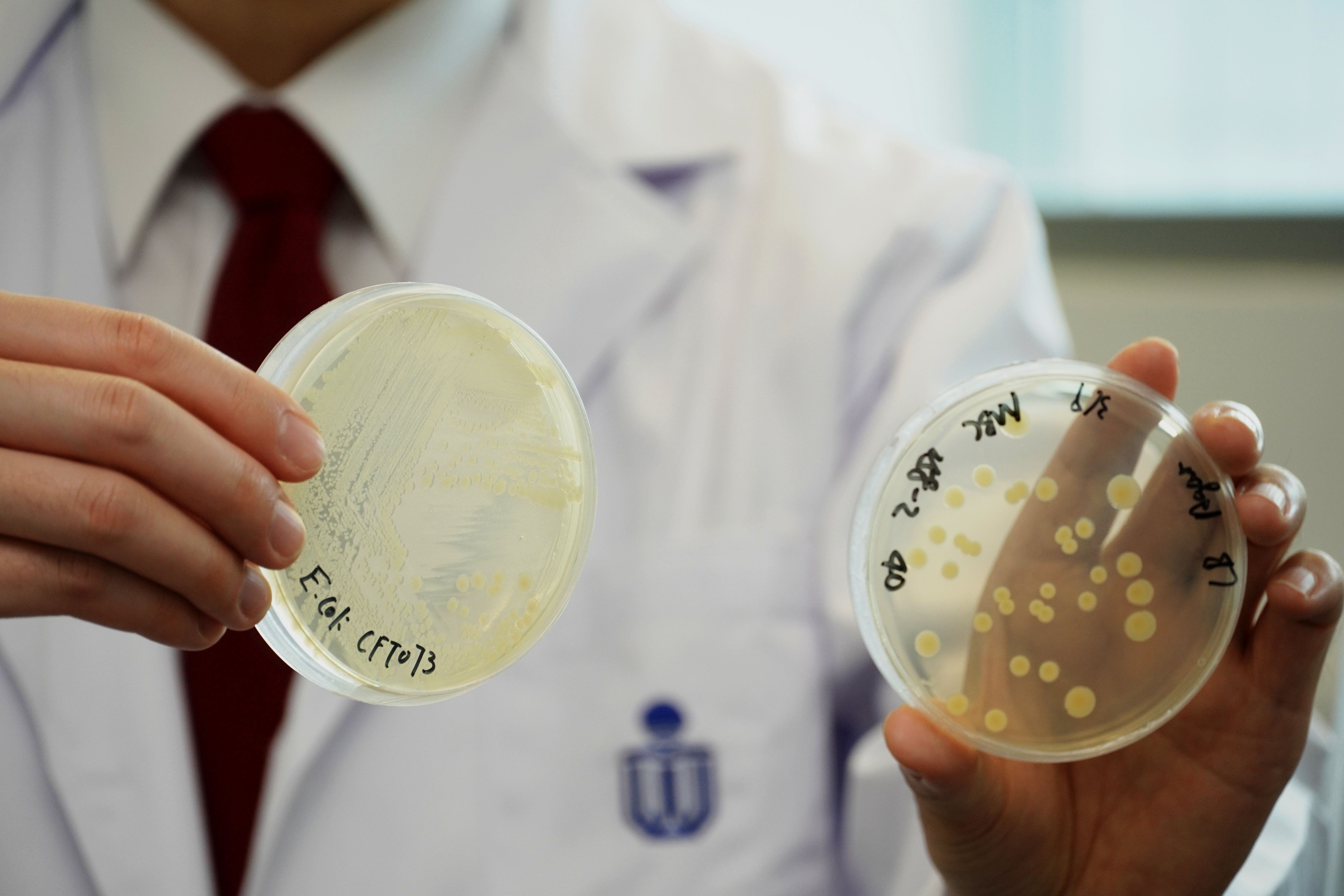 The dish on the left is the E. Coli cloned by the research team