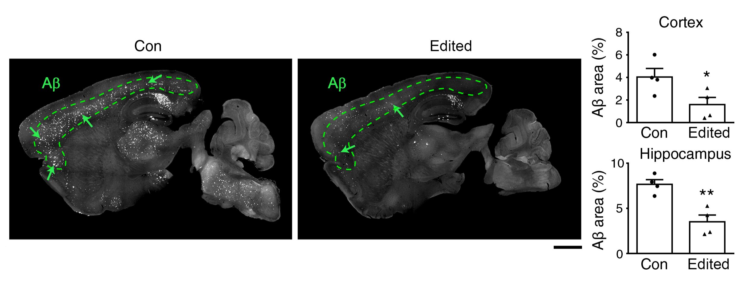 The level of amyloid (white shades in area encircled by green dotted lines) - the protein thought to drive neurodegeneration in AD, is high in the brain of AD mouse (left) and reduces after the administration of the genome editing therapy throughout the brain (right).